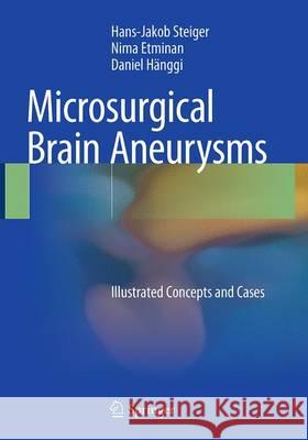 Microsurgical Brain Aneurysms: Illustrated Concepts and Cases Steiger, Hans-Jakob 9783662511190 Springer