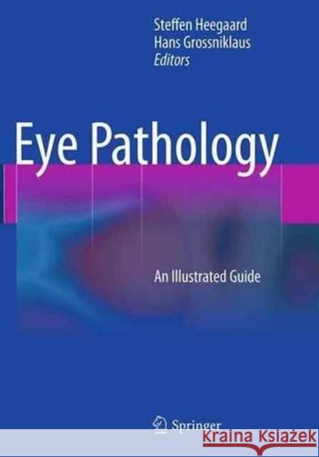 Eye Pathology: An Illustrated Guide Heegaard, Steffen 9783662511824 Springer