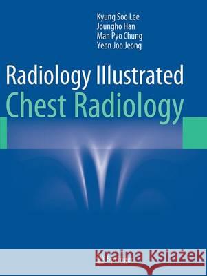 Radiology Illustrated: Chest Radiology Kyung Soo Lee Joungho Han Man Pyo Chung 9783662512876 Springer