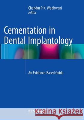 Cementation in Dental Implantology: An Evidence-Based Guide Wadhwani, Chandur P. K. 9783662512906