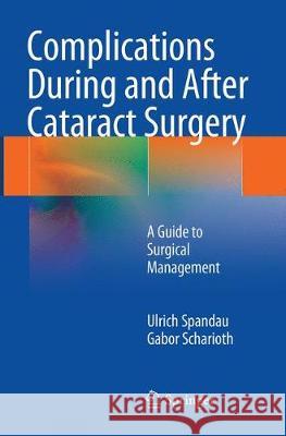 Complications During and After Cataract Surgery: A Guide to Surgical Management Spandau, Ulrich 9783662512920 Springer