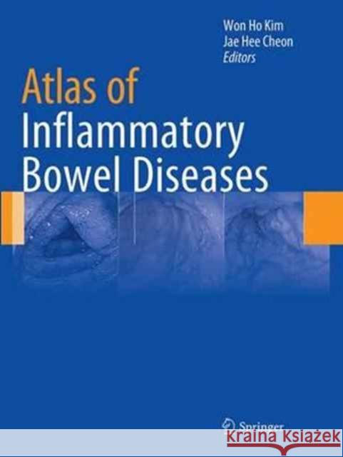 Atlas of Inflammatory Bowel Diseases Won Ho Kim Jae Hee Cheon 9783662513552 Springer