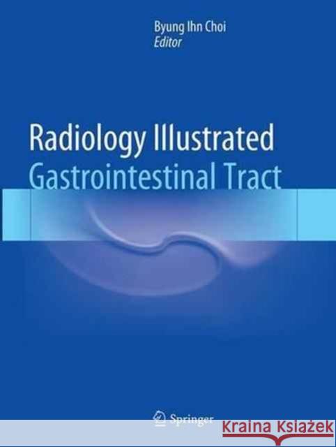 Radiology Illustrated: Gastrointestinal Tract Byung Ihn Choi 9783662514962 Springer