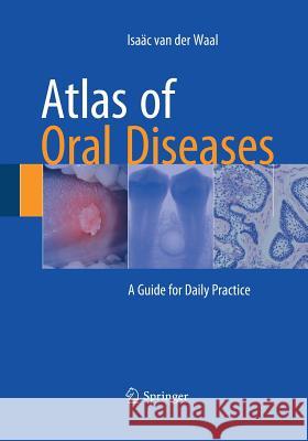 Atlas of Oral Diseases: A Guide for Daily Practice Van Der Waal, Isaäc 9783662517260 Springer