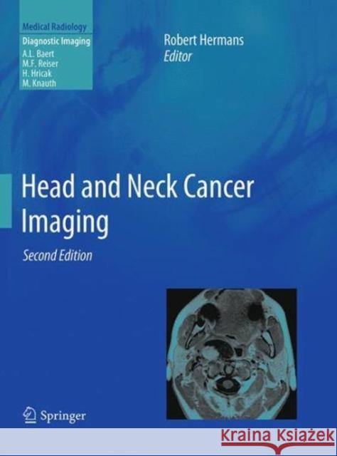 Head and Neck Cancer Imaging Robert Hermans 9783662517789