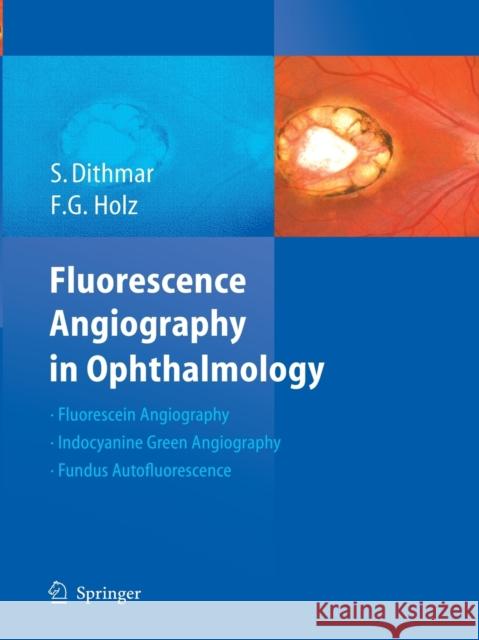 Fluorescence Angiography in Ophthalmology Stefan Dithmar Frank G. Holz 9783662517918 Springer