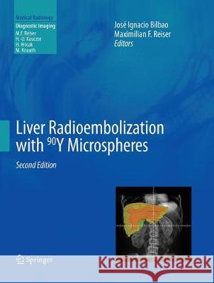 Liver Radioembolization with 90y Microspheres Bilbao, José Ignacio 9783662518182 Springer