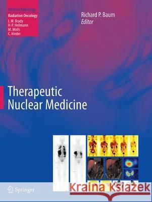 Therapeutic Nuclear Medicine Richard P. Baum 9783662518205