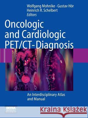 Oncologic and Cardiologic Pet/Ct-Diagnosis: An Interdisciplinary Atlas and Manual Mohnike, Wolfgang 9783662518441 Springer