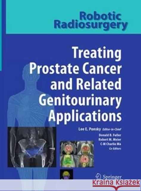 Treating Prostate Cancer and Related Genitourinary Applications Ponsky, Lee E. 9783662519608