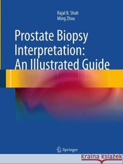 Prostate Biopsy Interpretation: An Illustrated Guide Rajal B. Shah Ming Zhou 9783662520093