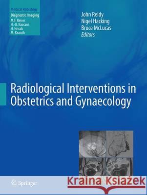 Radiological Interventions in Obstetrics and Gynaecology John Reidy Nigel Hacking Bruce McLucas 9783662520475 Springer