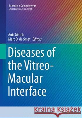 Diseases of the Vitreo-Macular Interface Aniz Girach Marc D. D 9783662521120 Springer