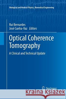 Optical Coherence Tomography: A Clinical and Technical Update Bernardes, Rui 9783662521182 Springer