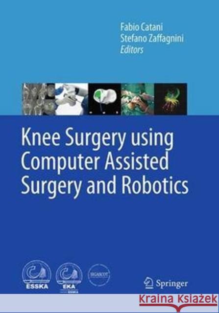 Knee Surgery Using Computer Assisted Surgery and Robotics Catani, Fabio 9783662521311 Springer