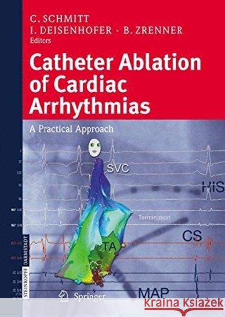 Catheter Ablation of Cardiac Arrhythmias: A Practical Approach Schmitt, C. 9783662526835 Steinkopff