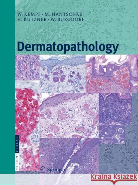 Dermatopathology Werner Kempf Markus Hantschke Heinz Kutzner 9783662526873 Steinkopff