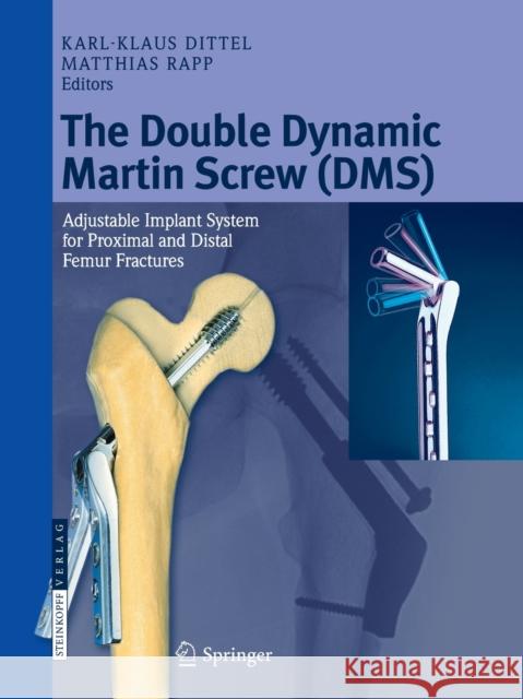 The Double Dynamic Martin Screw (DMS): Adjustable Implant System for Proximal and Distal Femur Fractures Dittel, Karl-Klaus 9783662526880 Steinkopff