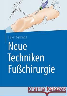 Neue Techniken Fußchirurgie Hajo Thermann 9783662527368 Springer