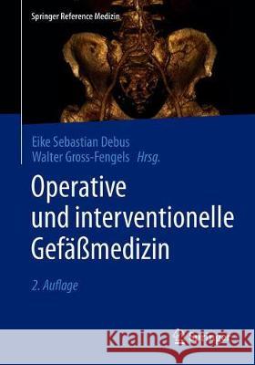 Operative Und Interventionelle Gefäßmedizin Debus, Eike Sebastian 9783662533789 Springer