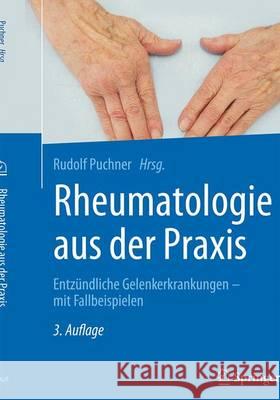 Rheumatologie Aus Der Praxis: Entzündliche Gelenkerkrankungen - Mit Fallbeispielen Puchner, Rudolf 9783662535684 Springer