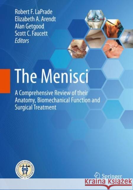 The Menisci: A Comprehensive Review of Their Anatomy, Biomechanical Function and Surgical Treatment Laprade, Robert F. 9783662537916