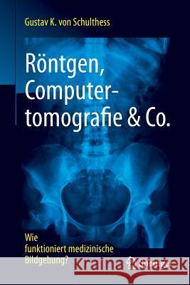 Röntgen, Computertomografie & Co.: Wie Funktioniert Medizinische Bildgebung? Von Schulthess, Gustav K. 9783662539309 Springer