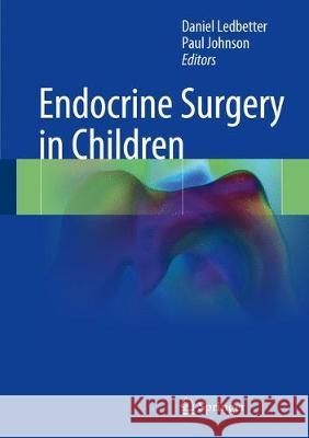 Endocrine Surgery in Children Daniel Ledbetter Paul Johnson 9783662542545 Springer