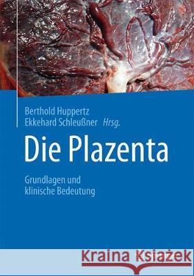 Die Plazenta: Grundlagen Und Klinische Bedeutung Huppertz, Berthold 9783662556214