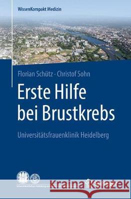 Erste Hilfe Bei Brustkrebs: Universitätsfrauenklinik Heidelberg Schütz, Florian 9783662557020 Springer