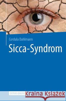 Sicca-Syndrom Cordula Dahlmann 9783662564080