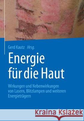 Energie Für Die Haut: Wirkungen Und Nebenwirkungen Von Lasern, Blitzlampen Und Weiteren Energieträgern Kautz, Gerd 9783662564356