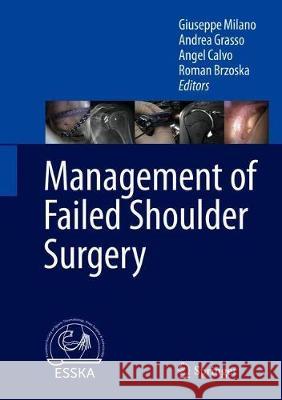 Management of Failed Shoulder Surgery Giuseppe Milano Andrea Grasso Angel Calvo 9783662565032 Springer