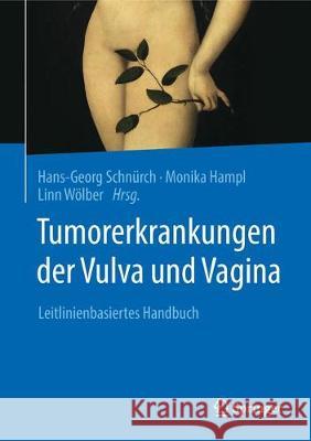 Tumorerkrankungen Der Vulva Und Vagina: Leitlinienbasiertes Handbuch Schnürch, Hans-Georg 9783662566350 Springer, Berlin