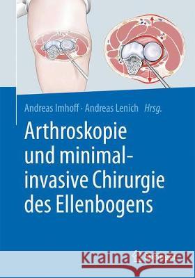 Arthroskopie Und Minimal-Invasive Chirurgie Des Ellenbogens Imhoff, Andreas B. 9783662566787