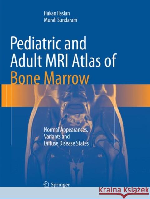 Pediatric and Adult MRI Atlas of Bone Marrow: Normal Appearances, Variants and Diffuse Disease States Ilaslan, Hakan 9783662568446 Springer