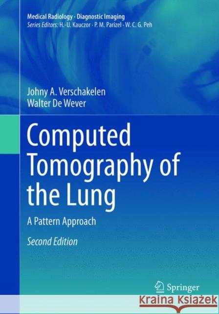 Computed Tomography of the Lung: A Pattern Approach Verschakelen, Johny A. 9783662568637 Springer