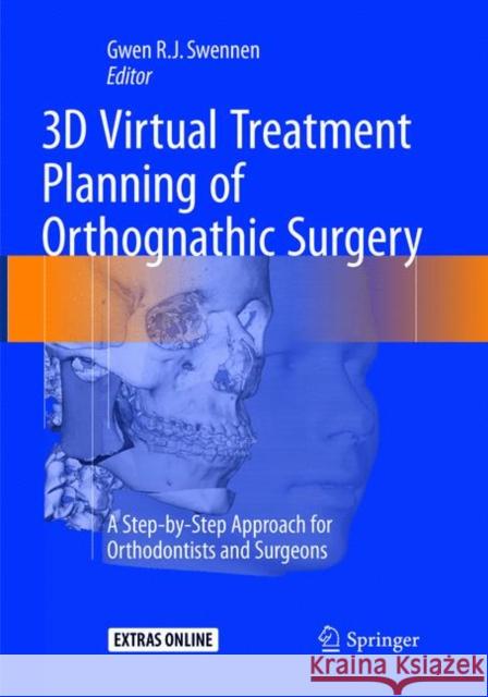 3D Virtual Treatment Planning of Orthognathic Surgery: A Step-By-Step Approach for Orthodontists and Surgeons Swennen, Gwen 9783662568965 Springer