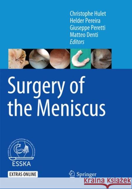 Surgery of the Meniscus Christophe Hulet Helder Pereira Giuseppe Peretti 9783662569917 Springer