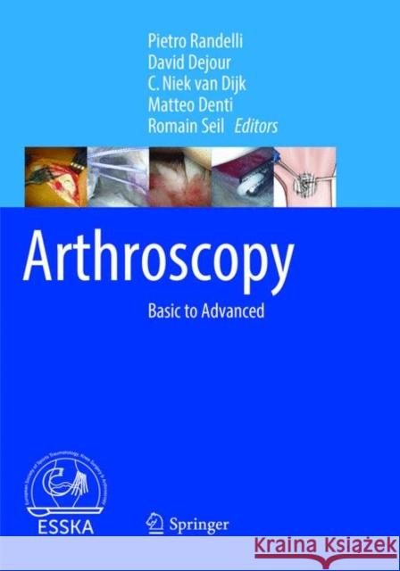 Arthroscopy: Basic to Advanced Randelli, Pietro 9783662570067 Springer