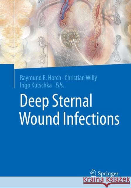 Deep Sternal Wound Infections Raymund E. Horch Christian Willy Ingo Kutschka 9783662570333