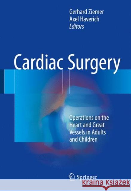 Cardiac Surgery: Operations on the Heart and Great Vessels in Adults and Children Ziemer, Gerhard 9783662570685 Springer