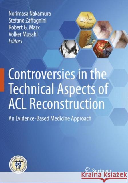 Controversies in the Technical Aspects of ACL Reconstruction: An Evidence-Based Medicine Approach Nakamura, Norimasa 9783662570777