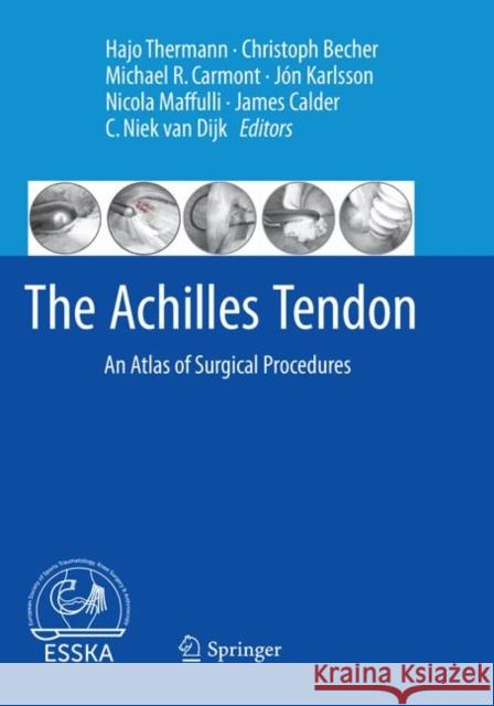 The Achilles Tendon: An Atlas of Surgical Procedures Thermann, Hajo 9783662571798 Springer