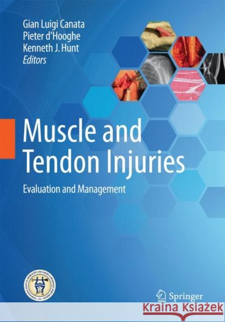 Muscle and Tendon Injuries: Evaluation and Management Canata, Gian Luigi 9783662571859 Springer