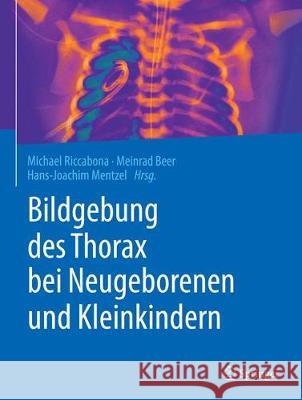 Bildgebung Des Thorax Bei Neugeborenen Und Kleinkindern Riccabona, Michael 9783662578131 Springer, Berlin