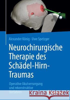 Neurochirurgische Therapie Des Schädel-Hirn-Traumas: Operative Akutversorgung Und Rekonstruktive Verfahren König, Alexander 9783662579275