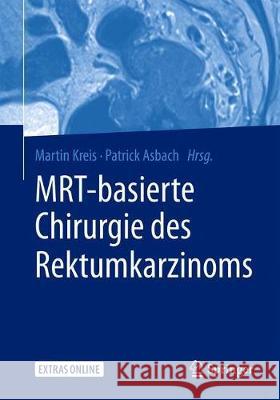 Mrt-Basierte Chirurgie Des Rektumkarzinoms Kreis, Martin E. 9783662581582 Springer