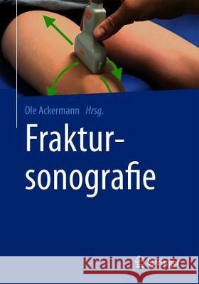 Fraktursonografie Ole Ackermann 9783662585078 Springer