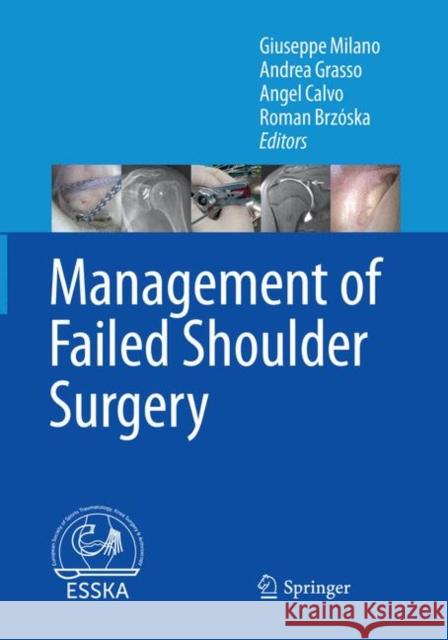 Management of Failed Shoulder Surgery Giuseppe Milano Andrea Grasso Angel Calvo 9783662585849 Springer